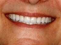 Konig Center for Cosmetic & Comprehensive Dentistry smile photos